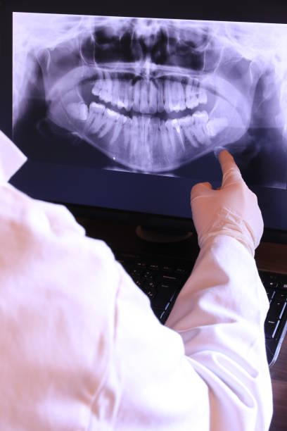 Best Emergency Dentist for Knocked-Out Tooth in Fairplay, GA