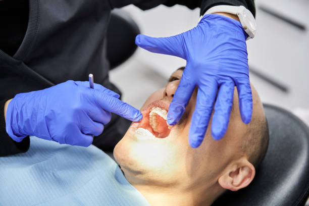 Best Emergency Dentist for Lost Fillings or Crowns in Fairplay, GA