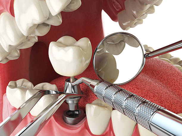 Best Weekend Emergency Dentist in Fairplay, GA