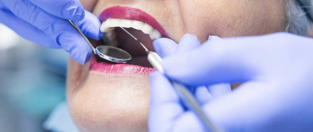 Best Emergency Dental Extractions in Fairplay, GA